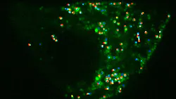 The motion of insulin-containing vesicles, which contain thousands of insulin molecules within an insulin-secreting cell, was studied via particle-tracking software. This work stimulated collaborative research that led to the development of the single-pixel interior filling function (SPIFF) by scientists at the University of Chicago. The motion of insulin-containing vesicles, which contain thousands of insulin molecules within an insulin-secreting cell, was studied via particle-tracking software. This work stimulated collaborative research that led to the development of the single-pixel interior filling function (SPIFF) by scientists at the University of Chicago.