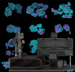 Viventis SCAPE - Single Objective Light Sheet Microscope for fast and gentle volumetric imaging Viventis SCAPE - Single Objective Light Sheet Microscope for fast and gentle volumetric imaging