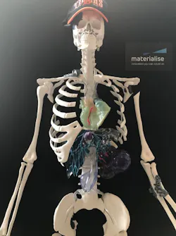 Www Machinedesign Com Sites Machinedesign com Files Skeleton 1 Www Machinedesign Com Sites Machinedesign com Files Skeleton 1