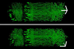The expanded neurons from the hippocampus are on the right They are more easily observed than the original condensed neurons on the left The expanded neurons from the hippocampus are on the right They are more easily observed than the original condensed neurons on the left
