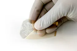 The smart bandage is fabricated by printing gold electrodes onto a thin piece of plastic This flexible sensor uses impedance spectroscopy to detect bedsores that are invisible to the naked eye The smart bandage is fabricated by printing gold electrodes onto a thin piece of plastic This flexible sensor uses impedance spectroscopy to detect bedsores that are invisible to the naked eye