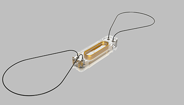 The CardioMEMS sensor is the size of a dime and is implanted in the pulmonary artery to help monitor increases in pressure The wire loops seen above are made of nitinol and extend from each end of the sensor This stabilizes the sensor in the implant location