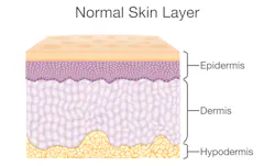 Machinedesign Com Sites Machinedesign com Files Skinfig1 806904670 Machinedesign Com Sites Machinedesign com Files Skinfig1 806904670