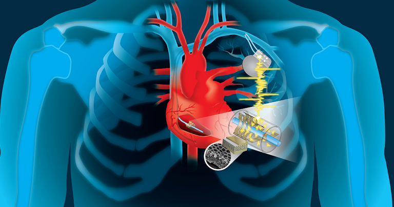 The Power Of The Heartbeat To Charge Medical Devices Machine Design