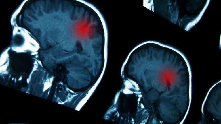 Ai Makes Ct Scans Safer And More Informative Machine Design Ai Makes Ct Scans Safer And More Informative Machine Design