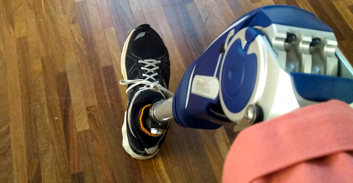 Personalized Prosthetic Liners Could Help Amputees Walk Again Machine Design