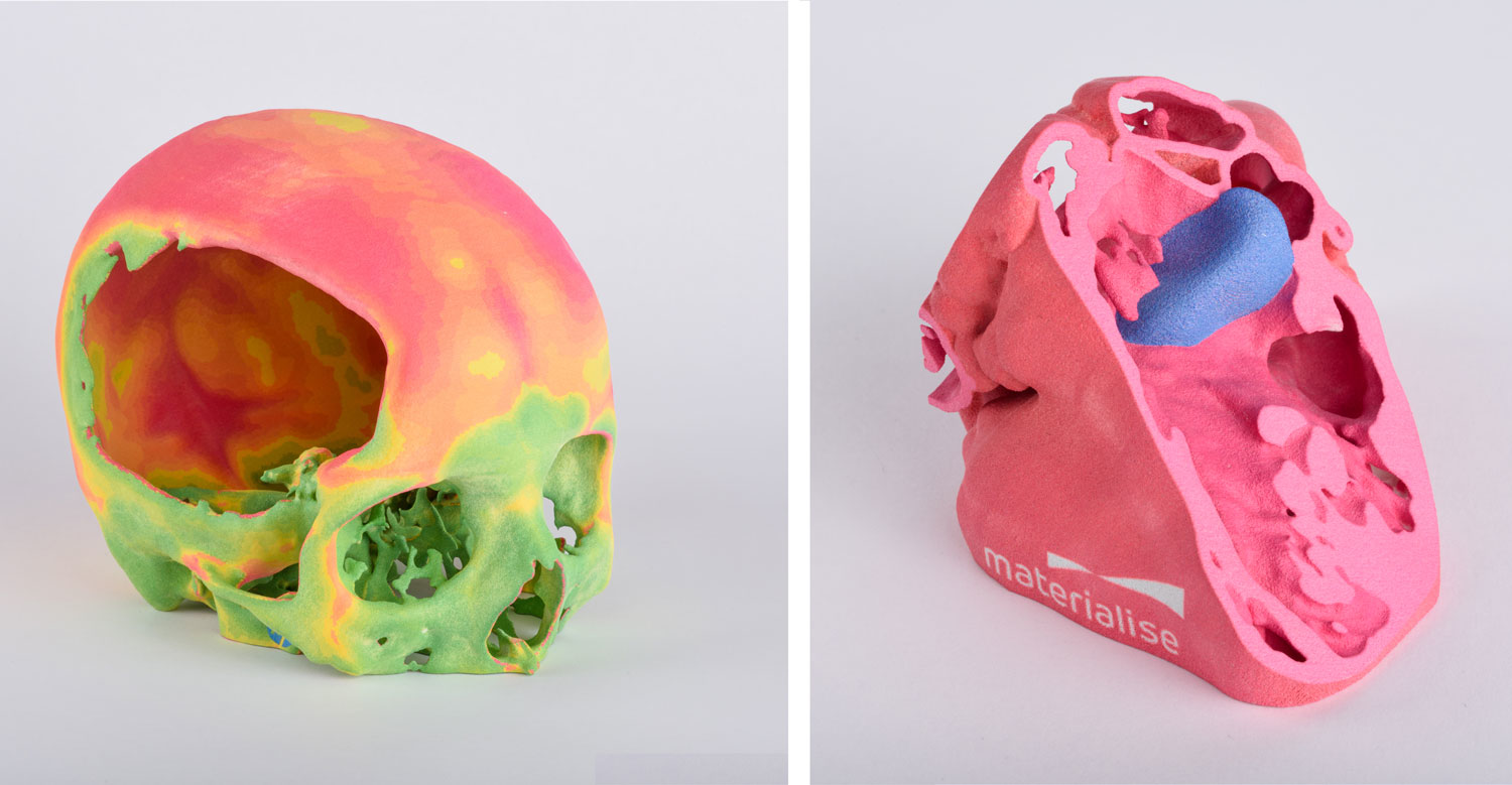 Skull model