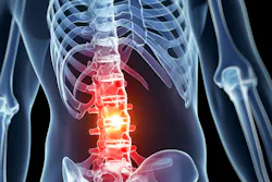Spinal cord cure Spinal cord cure