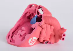 Machinedesign Com Sites Machinedesign com Files Congenital Heart 1 Machinedesign Com Sites Machinedesign com Files Congenital Heart 1