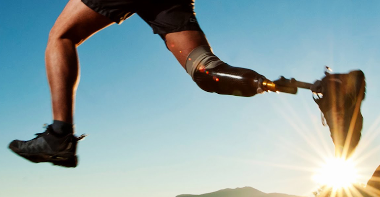 Prosthetics essay 04 picture