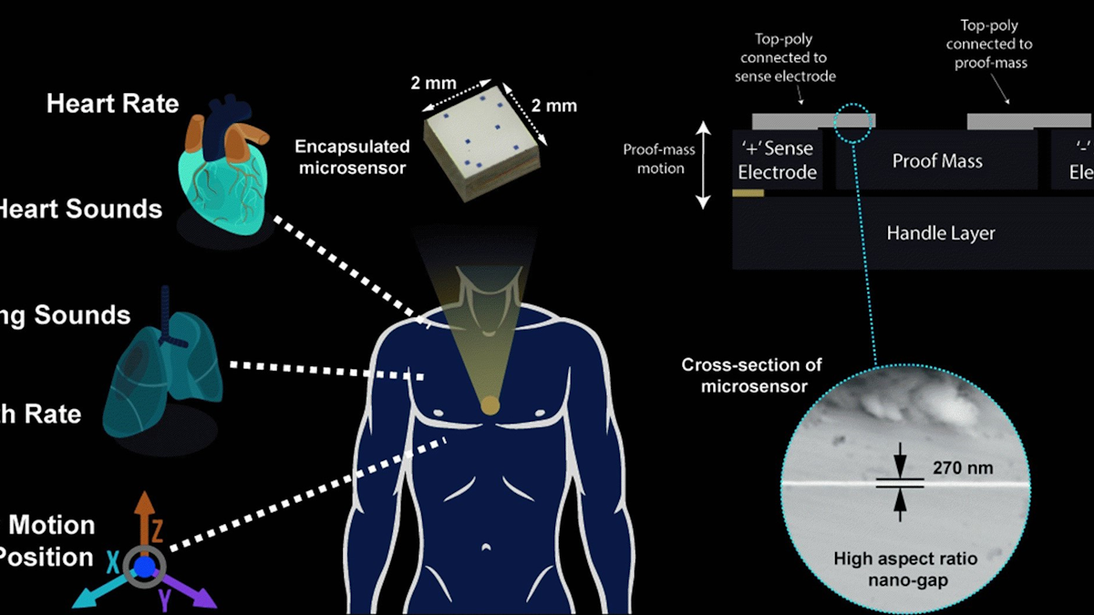 Tiny Sensor Acts As A High Tech Stethoscope Machine Design