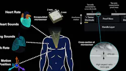 Medical sensor Medical sensor