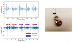 A small and inexpensive sensor, announced in Applied Physics Letters and based on an electrochemical system, could potentially be worn continuously by cardiac patients or others who require constant monitoring. Right: Wearable sensor attached to a patient’s chest. Top left: Heartbeat signal acquired from the sensor. Bottom left: Acquired breathing signal. A small and inexpensive sensor, announced in Applied Physics Letters and based on an electrochemical system, could potentially be worn continuously by cardiac patients or others who require constant monitoring. Right: Wearable sensor attached to a patient’s chest. Top left: Heartbeat signal acquired from the sensor. Bottom left: Acquired breathing signal.