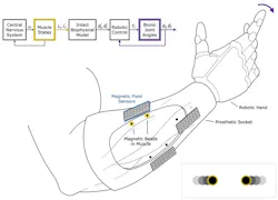 1. Free-space control of a robotic prosthesis via muscle magnetomicrometry: Passive magnetic beads (in yellow) implanted in muscle can be used to wirelessly track muscle length via an array of magnetic field sensors (blue) mounted to the outside of the body. The pair of magnetic beads highlighted here is placed in a single muscle, in line with the muscle fiber orientation. Muscle-length data can be streamed to a control unit, which in turn can be used to stream commands to neuroprosthetic devices such as exoskeletons, muscle stimulators, or the robotic hand shown here. 1. Free-space control of a robotic prosthesis via muscle magnetomicrometry: Passive magnetic beads (in yellow) implanted in muscle can be used to wirelessly track muscle length via an array of magnetic field sensors (blue) mounted to the outside of the body. The pair of magnetic beads highlighted here is placed in a single muscle, in line with the muscle fiber orientation. Muscle-length data can be streamed to a control unit, which in turn can be used to stream commands to neuroprosthetic devices such as exoskeletons, muscle stimulators, or the robotic hand shown here.