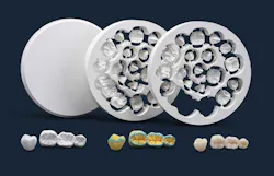 Every product that comes out of Glidewell’s BruxZir factory is Lot Size 1: Blanks are selected based on patient-specific characteristics and milled according to custom projects. Every product that comes out of Glidewell’s BruxZir factory is Lot Size 1: Blanks are selected based on patient-specific characteristics and milled according to custom projects.