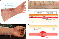 Ed Blood Pressure Tattoo Interest Fig1 62fe52104b69c Ed Blood Pressure Tattoo Interest Fig1 62fe52104b69c