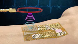 The biofilm The biofilm