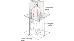 Illustration of transverse, sagital and frontal planes Illustration of transverse, sagital and frontal planes