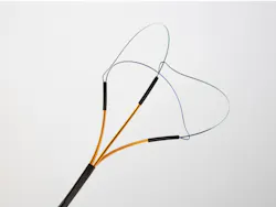 Nitinol retrieval basket from Endosmart, now an Alleima company. Nitinol retrieval basket from Endosmart, now an Alleima company.