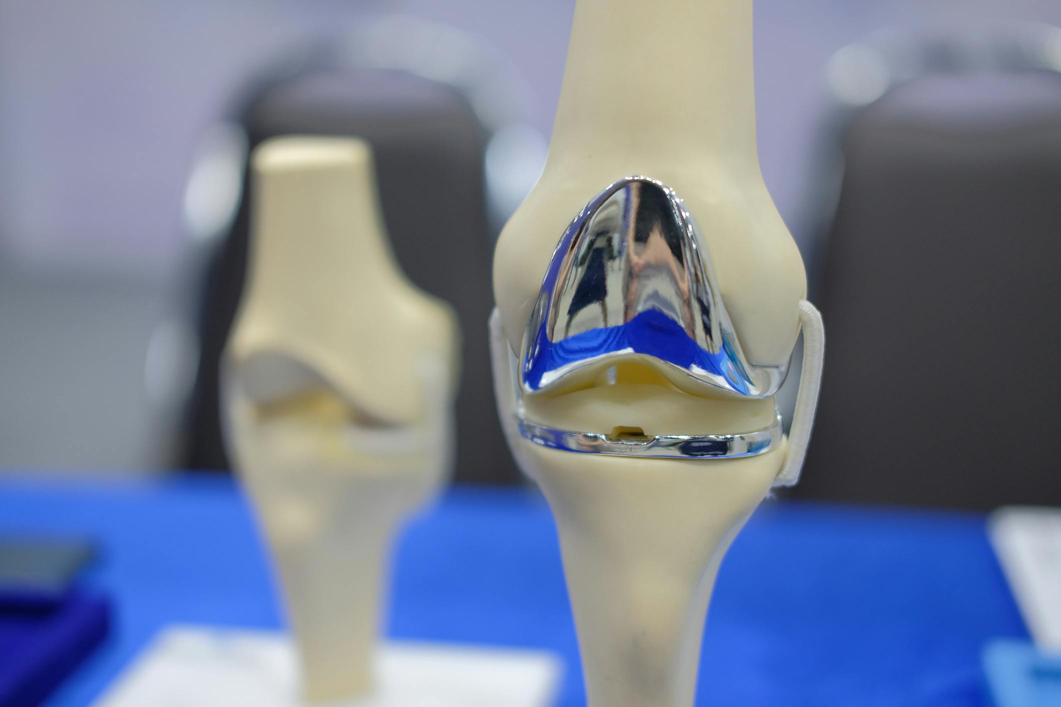 Knee joint model after replacement surgery