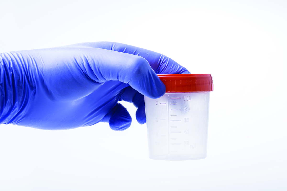 How to Drug Test Employees after States Adopt Varying Levels of