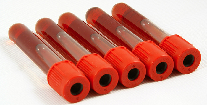 Mlo Generic Immunology