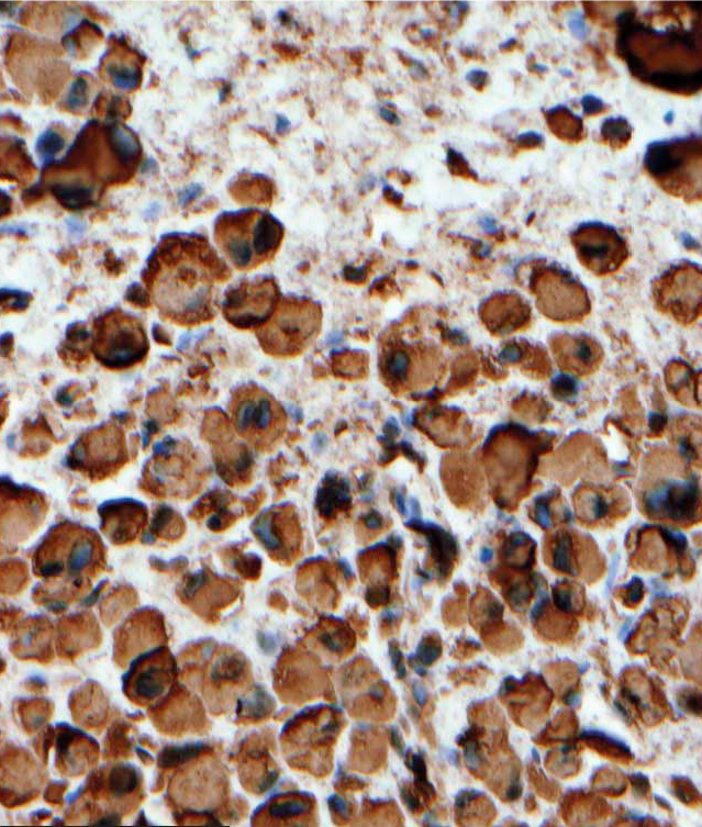 Dako Figure 2 Fi Adding Quality To Your Qualitative Ihc