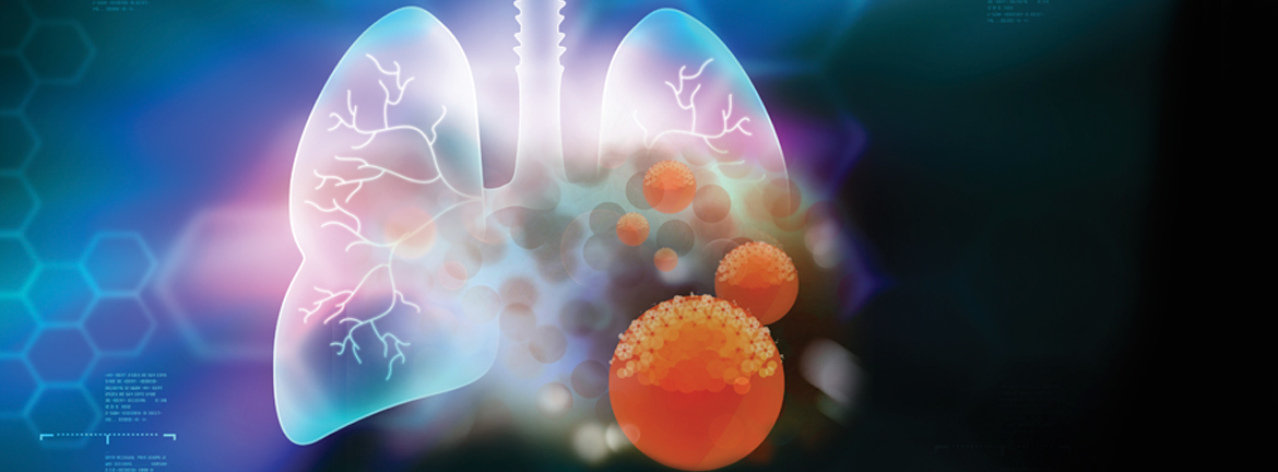 Slider1 Image Mlo201603 Severesepsis