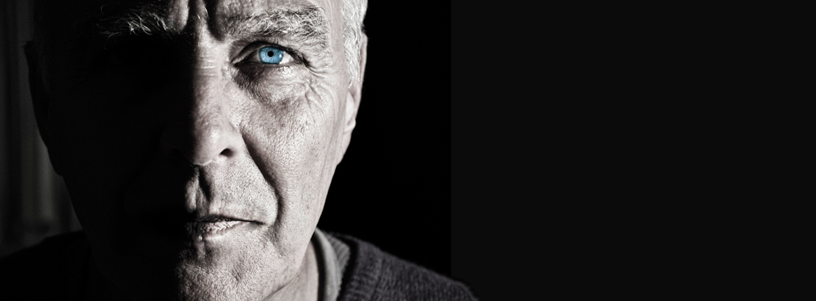 Slider1 Image Androgen