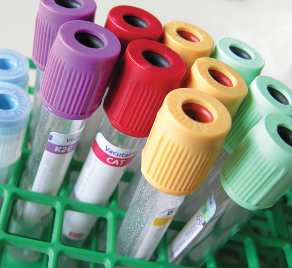 Mlo Special Feature Bio Rad2 Tubes