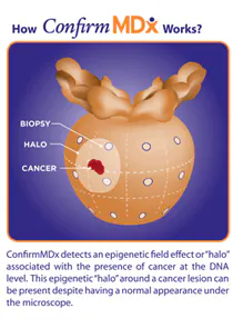 L13 Art Product Focus M Dx Health 151 L13 Art Product Focus M Dx Health 151
