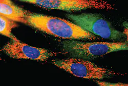 Cellular Cytomegalovirus Infection as indicated by the red spots Cellular Cytomegalovirus Infection as indicated by the red spots