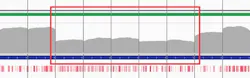 Figure 4b. Targeted sequencing of two samples with confirmed CNVs in LDLR. Heterozygous deletions (red boxes) and mid-exon breakpoint (red arrow) are clearly visible. (Samples provided courtesy of Mafalda Bourbon, PhD, Instituto Nacional de Saúde Doutor Ricardo Jorge.) All images courtesy of Oxford Gene Technology. Figure 4b. Targeted sequencing of two samples with confirmed CNVs in LDLR. Heterozygous deletions (red boxes) and mid-exon breakpoint (red arrow) are clearly visible. (Samples provided courtesy of Mafalda Bourbon, PhD, Instituto Nacional de Saúde Doutor Ricardo Jorge.) All images courtesy of Oxford Gene Technology.