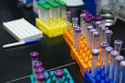 Needpix Colorful Test Tubes 4187286 1280 1 5ec5317ae8cc6 Needpix Colorful Test Tubes 4187286 1280 1 5ec5317ae8cc6