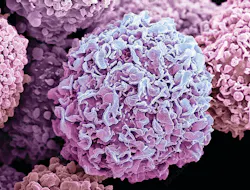 Breast Cancer Cells Photos 5ede3b0978ecf Breast Cancer Cells Photos 5ede3b0978ecf