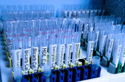 Pixabay Test 218181 1280 5fad45083db4f Pixabay Test 218181 1280 5fad45083db4f