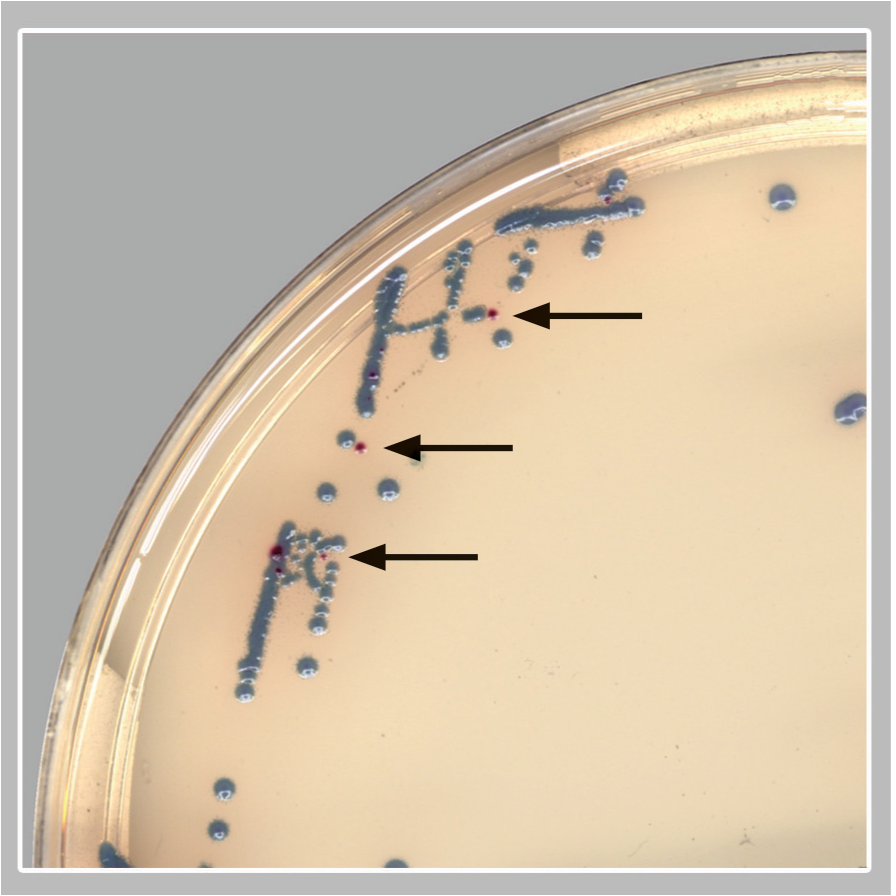 Box inset; GBS colonies (pink/red colonies; black arrows).