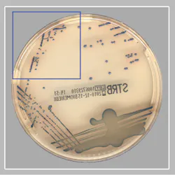 Software positive / manual read negative specimen (true positive GBS culture) Software positive / manual read negative specimen (true positive GBS culture)