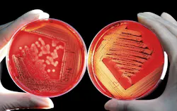 Agar 60571 1280 1 60b63abee5add Agar 60571 1280 1 60b63abee5add