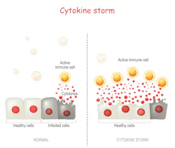 Cytokine Storm Illustration 199570532 By Designua At Dreamstime Cytokine Storm Illustration 199570532 By Designua At Dreamstime