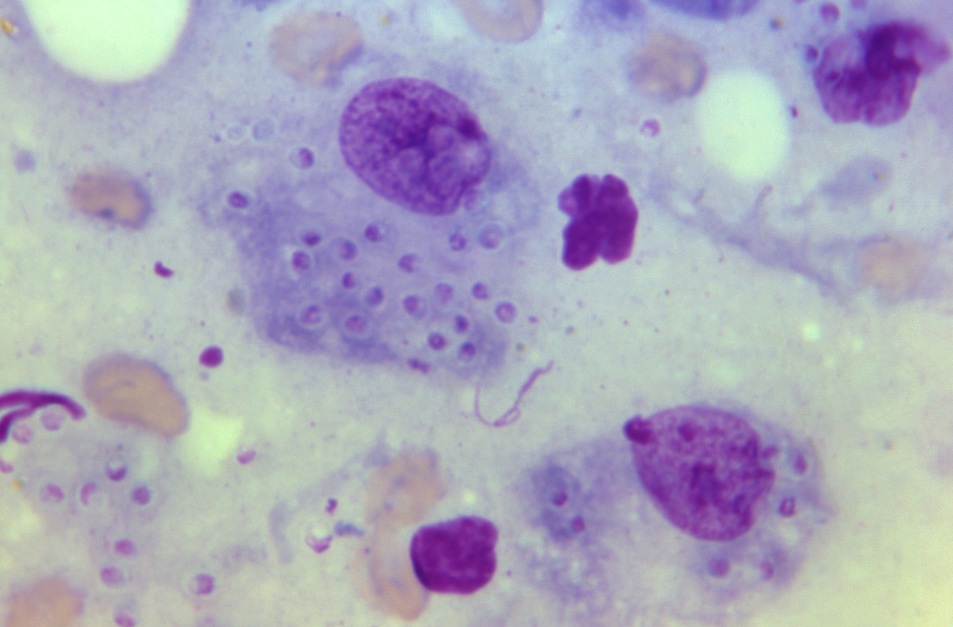 Macrophage Courtesy Cdc 60f6c94a290cf