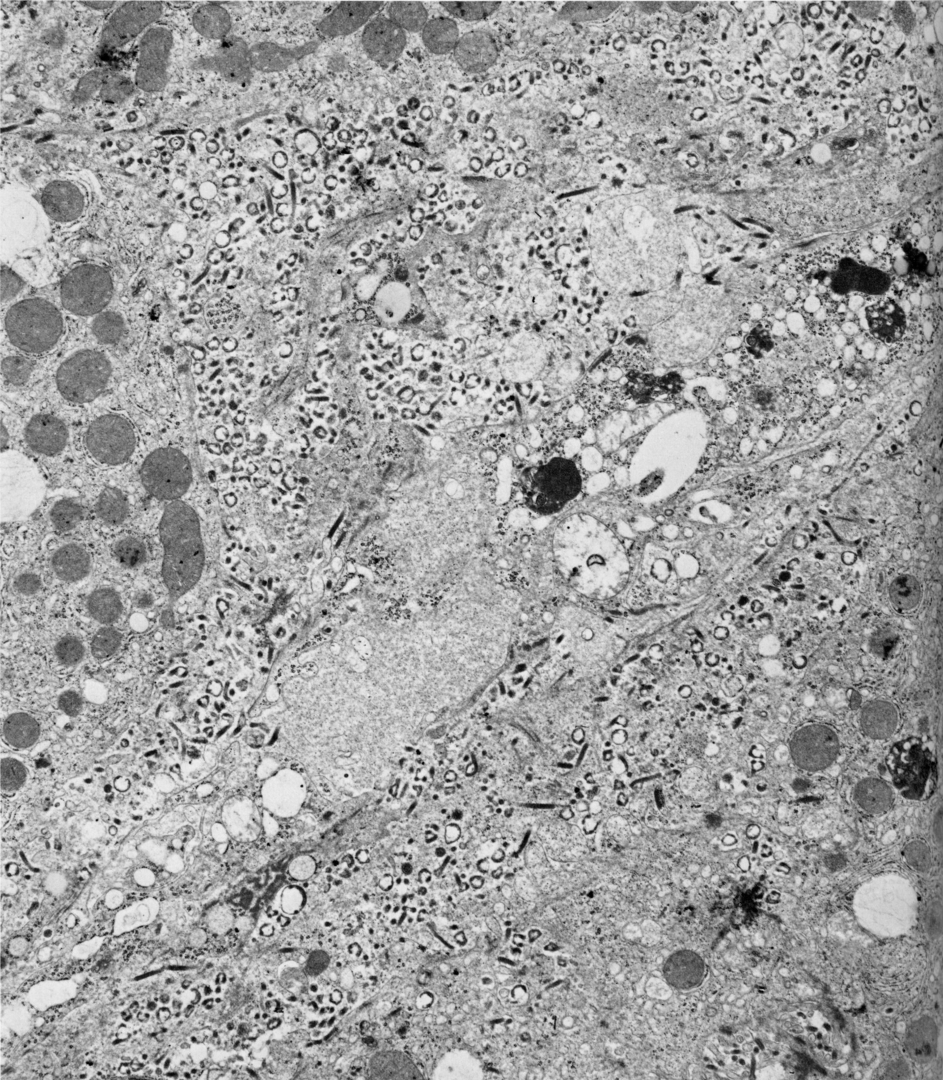 Marburg Virus Courtesy Cdc 611276601165e