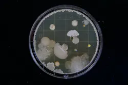 Bacterial Culture Photo By Michael Schiffer On Unsplash 6112715282a5e Bacterial Culture Photo By Michael Schiffer On Unsplash 6112715282a5e