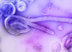 Ebola Isolate Photo By Cdc On Unsplash 611d007094a0f Ebola Isolate Photo By Cdc On Unsplash 611d007094a0f