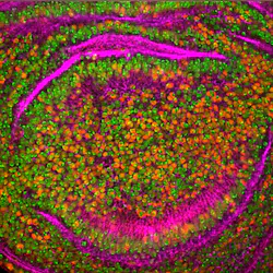 Leukemia Fruitfly Photo By National Cancer Institute On Unsplash 610bdbdf93dea Leukemia Fruitfly Photo By National Cancer Institute On Unsplash 610bdbdf93dea