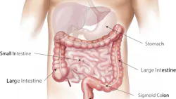 Abdomen 1698565 1920 Image By Bodymybody From Pixabay 614c7bca4450a Abdomen 1698565 1920 Image By Bodymybody From Pixabay 614c7bca4450a