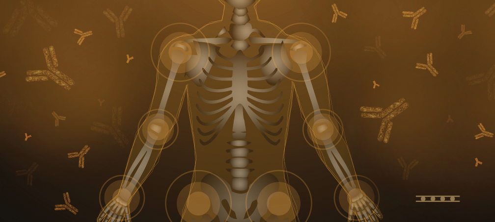 Ra Header Image Mlo 61956eed0cbe1