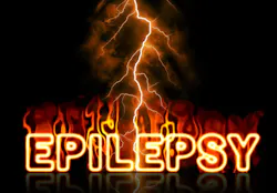 Pixabay Epilepsy Fire G9cafe8fc9 1280 624afed1a642c Pixabay Epilepsy Fire G9cafe8fc9 1280 624afed1a642c