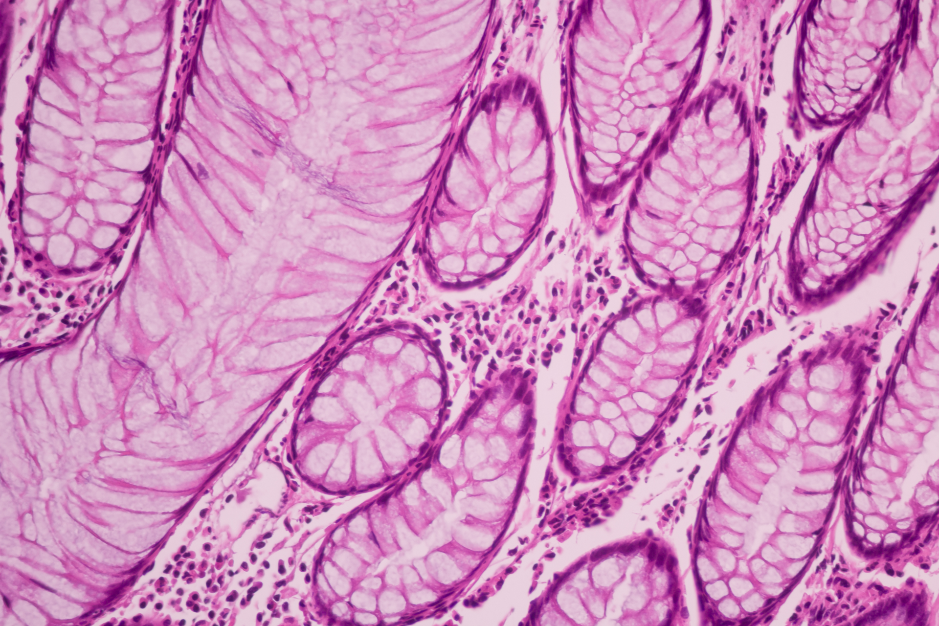 Adobe Cancer Adobe Stock 320367315 628f88c061f5d