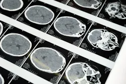Pexels Brain Mri Pexels Cottonbro 5723883 1 6279275805be6 Pexels Brain Mri Pexels Cottonbro 5723883 1 6279275805be6